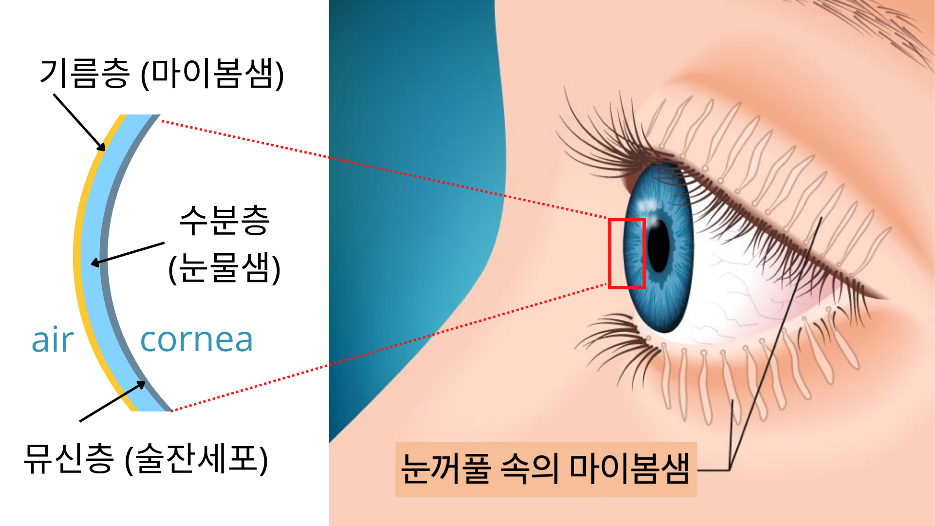 Professor Euiheon Chung's joint research team quantifies the loss of eyelid mybomsaem with artificial intelligence! 이미지