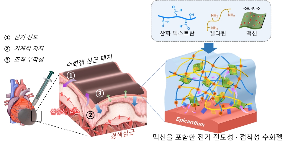 New Materials Professor Jae Young Lee's joing research team, GIST-Chonnam National University Hospital develops hydrogel myocardial patch, "Treat myocardial infarction by applying it to the heart" 이미지
