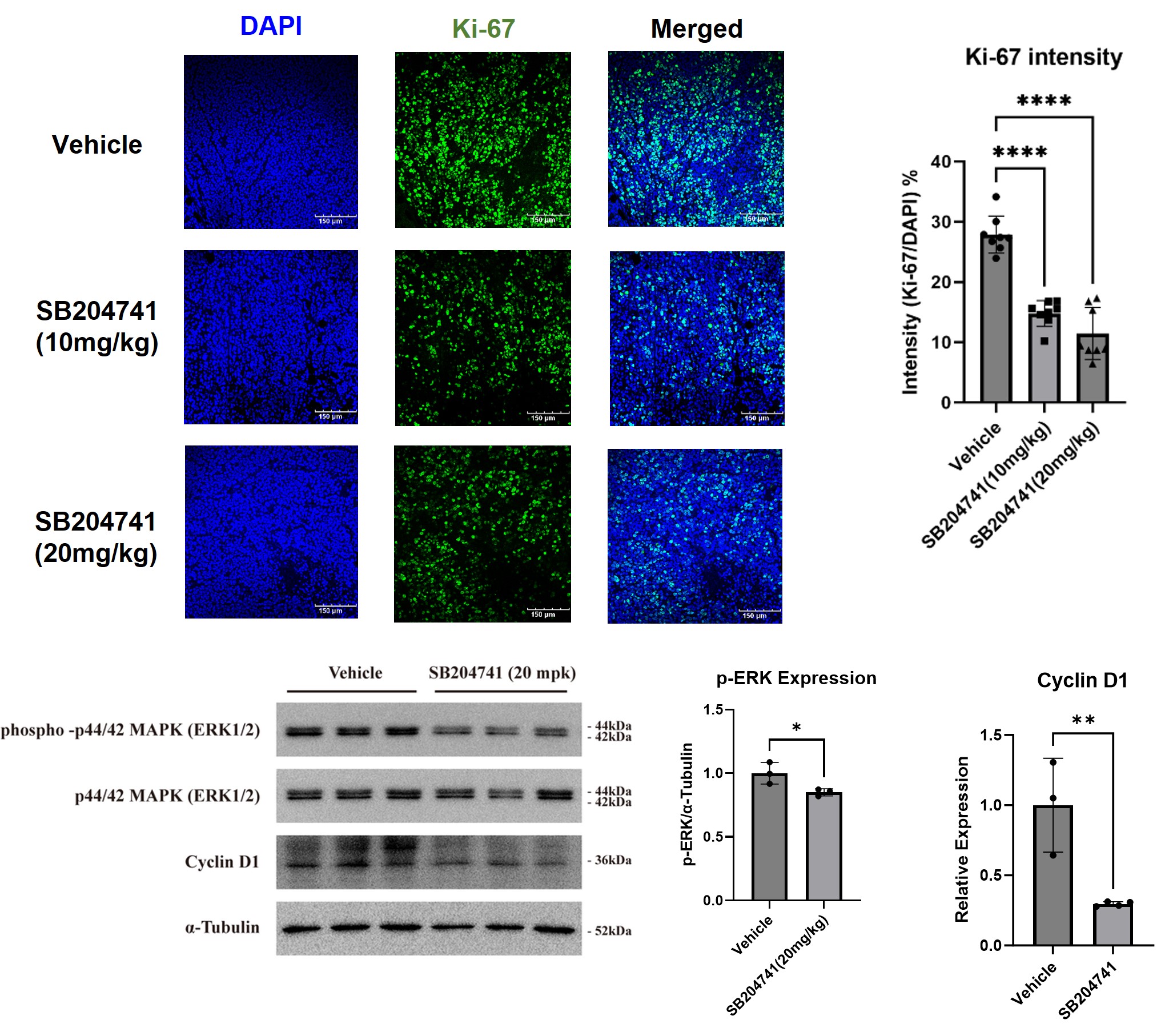 Professor Chang-Myung Oh and Professor Jin Hee Ahn's joint research team suggests the possibility of treating colon cancer by controlling the neurotransmitter 'serotonin' 이미지