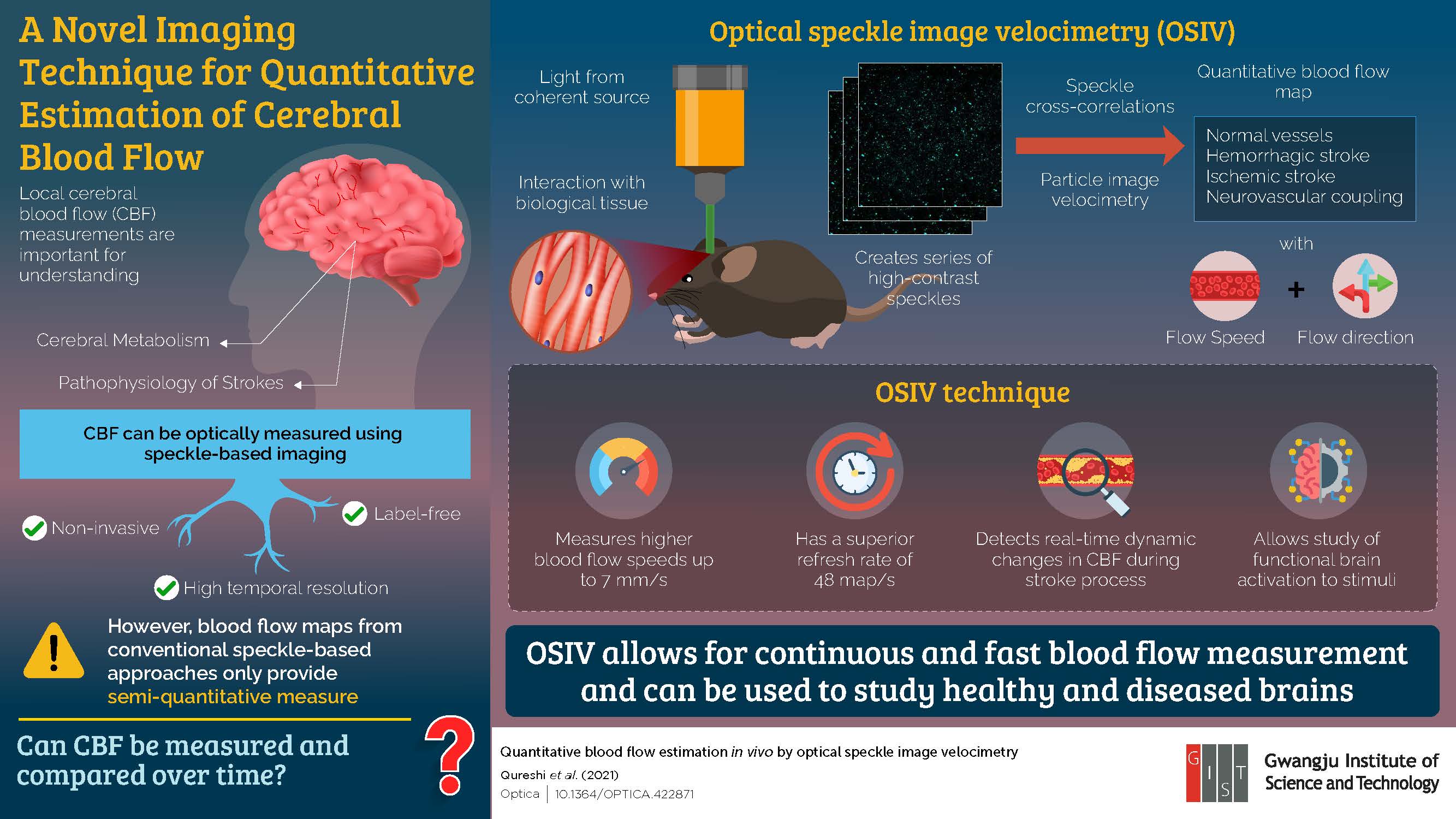 Gwangju Institute of Science and Technology Scientists Shine Light to Measure Blood Flow in the Brain in Real Time 이미지