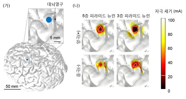 [보도자료] 뇌 전기 자극 정확성 높이는 시뮬레이션 기법 개발 이미지