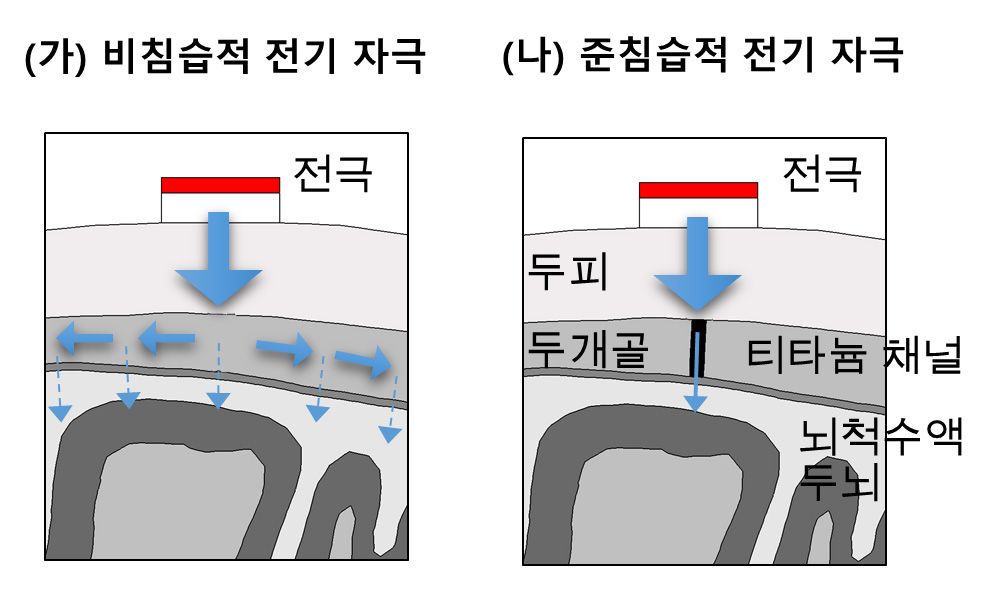 [보도자료] 전성찬 교수팀, 컴퓨팅 모델로 ‘준침습성 뇌 전기 자극’ 효과 입증 이미지