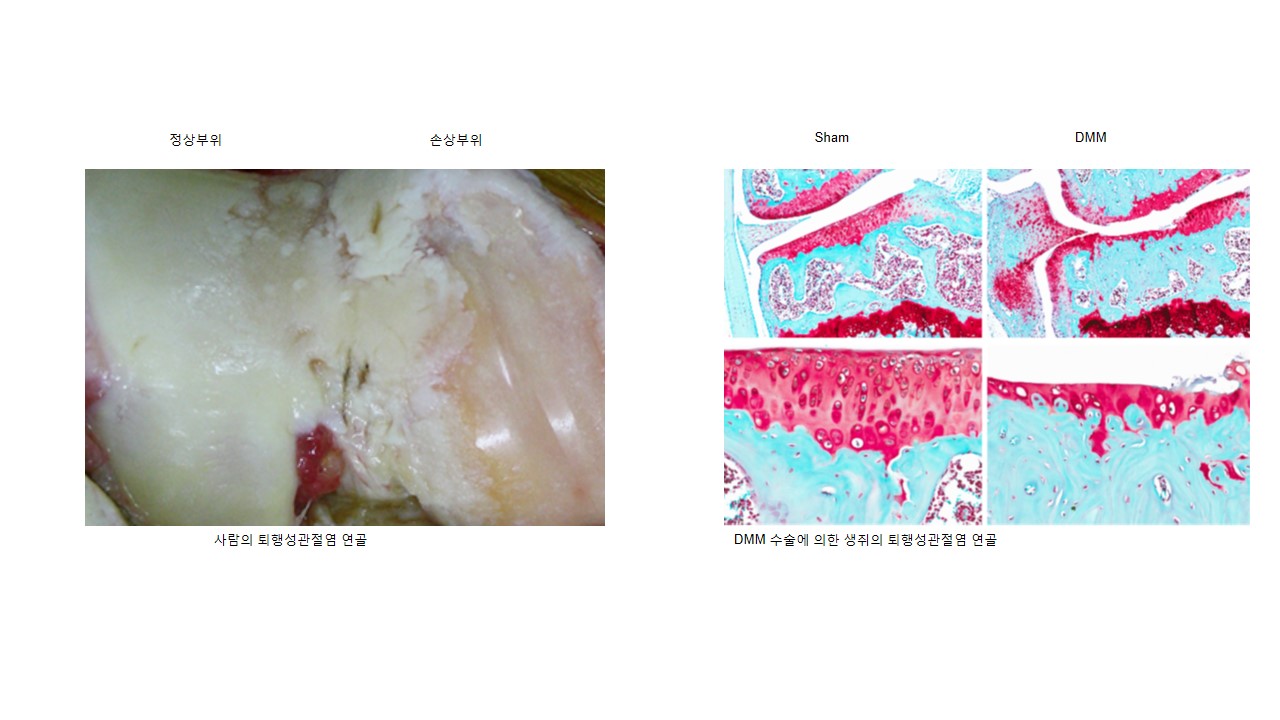 [Nature지 게재] 전장수 교수 공동연구팀, 퇴행성관절염의 원인은 콜레스테롤!(과기정통부) 이미지