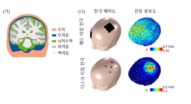 전성찬 교수 연구팀, 뇌기능 향상을 위한 전기 자극의 전류 분포와 세포간의 상호관계 규명 이미지