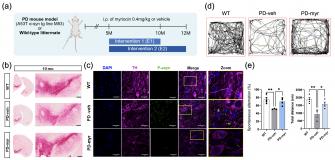 단백질 엉킴 유발 ‘지방’ 조절하니 파킨슨병 진행 늦춰... GIST  파킨슨병 ‘핵심 병리 경로’ 차단 전략 제시 사진