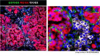 “암이 자라기 전, 몸 안에서는 ‘토양’이 바뀌고 있었다” GIST, 폐암 발생 이전 ‘종양 친화적 미세환경’ 형성 과정 세계 최초 규명 사진