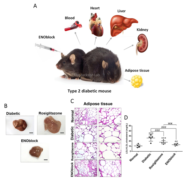 Professor Darren Williams's research team develops a treatment to alleviate symptoms of diabetes 이미지