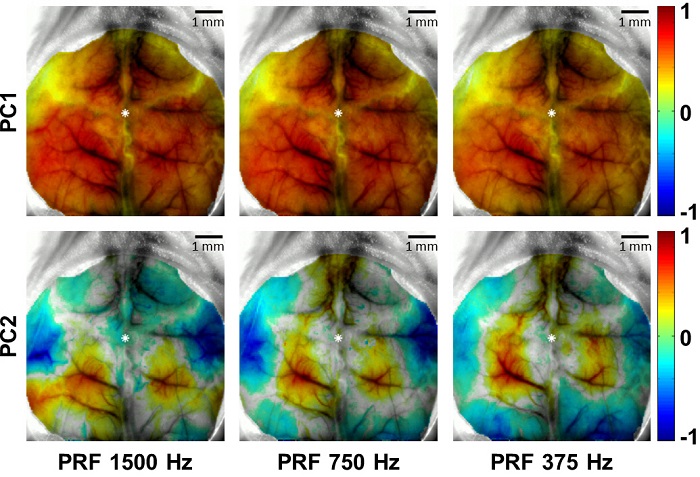 Professor Jae Gwon Kim's research team monitors ultrasonic brain stimulation using optical imaging 이미지