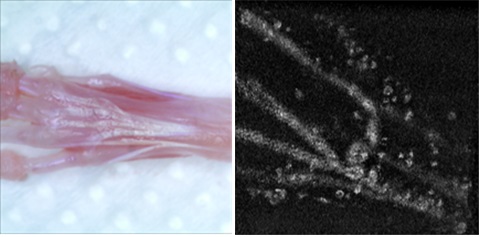 Advanced Photonics Research Institute: Dr. Tae Joong Eom's research team has developed a photoacoustic imaging technique to reveal the three-dimensional shape of tendons 이미지