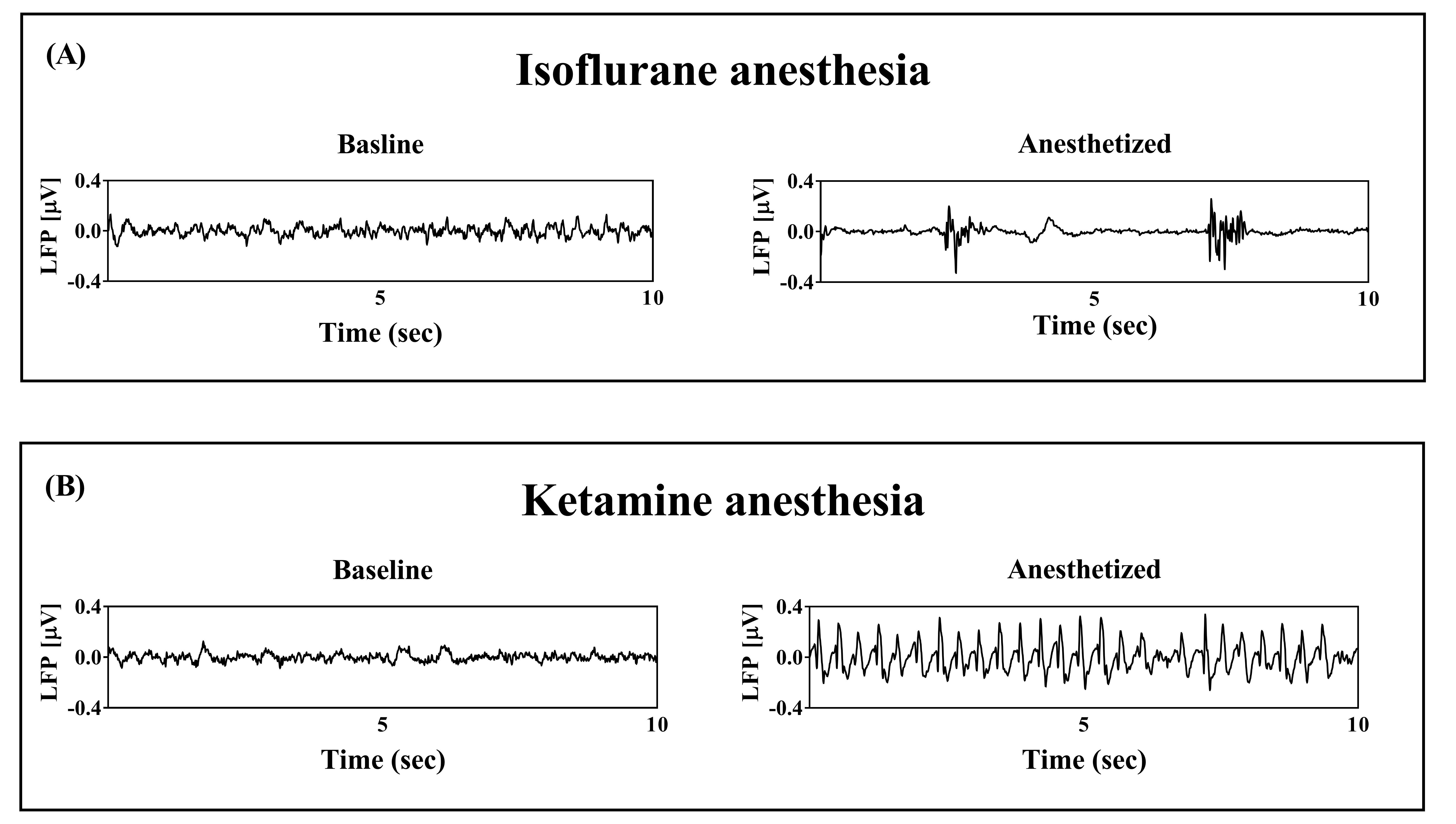 Professor Jae Gwan Kim’s research team uses near-infrared spectroscopy to monitor cerebral hemodynamics and conscious state change during anesthesia 이미지