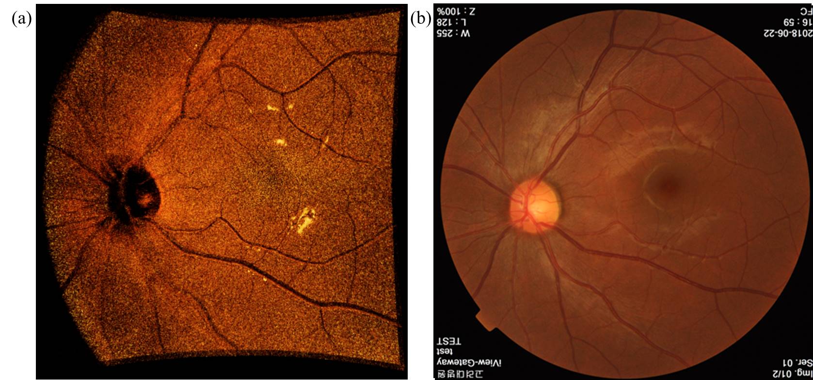 APRI Dr. Tae Joong Eom's joint research team develops core laser technology for optical medical devices for retinal imaging 이미지