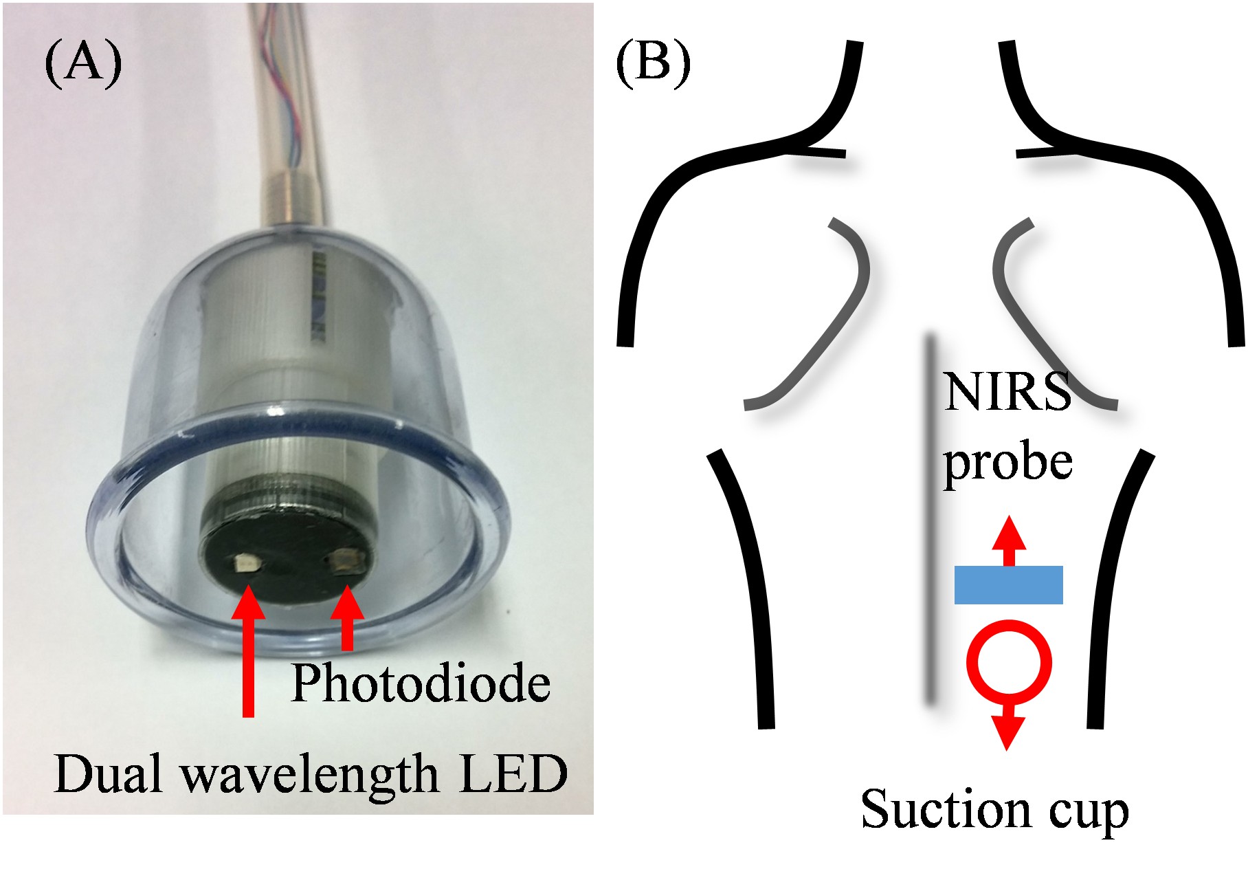 Professor Jae Gwan Kim's joint research team has developed a personalized treatment system based on near-infrared spectroscopic sensors 이미지