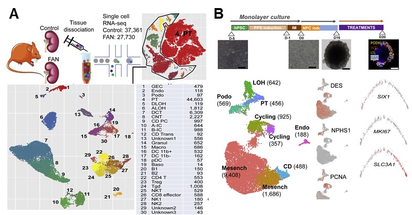 Professor Jihwan Park's joint research team presents new treatment possibilities for chronic kidney disease with new technology that looks at tens of thousands of cells one by one 이미지