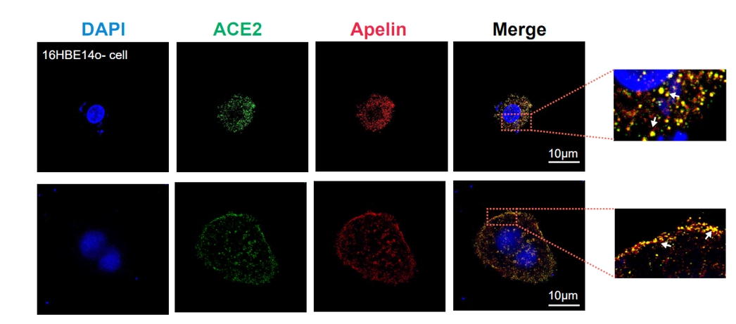 Professor Chang-Myung Oh's research team confirms the possibility of treating COVID-19 with 'peptide supplement' 이미지