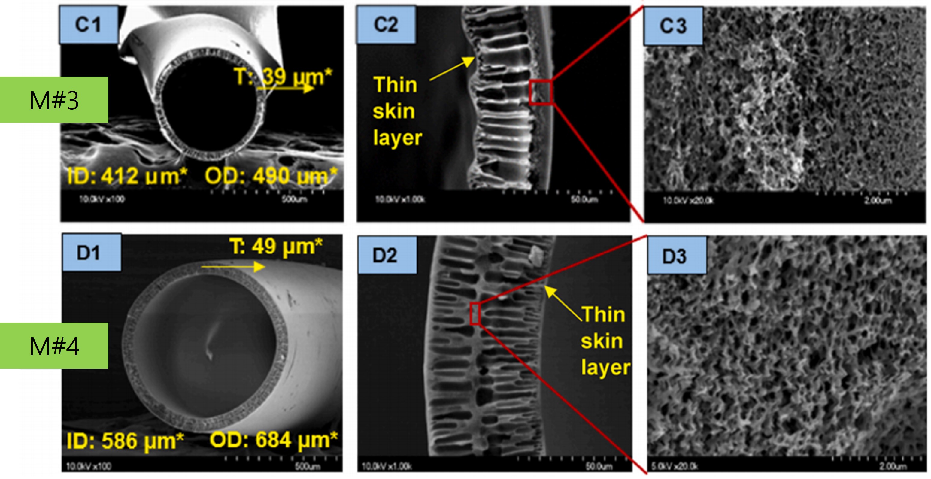 Professor In S. Kim's joint research team has made a 'stride' to localize blood filters for patients with end-stage renal disease... Succeeded in domestic development of ‘Hollow Fiber Membrane for Hemodialysis’ dependent on imports 이미지