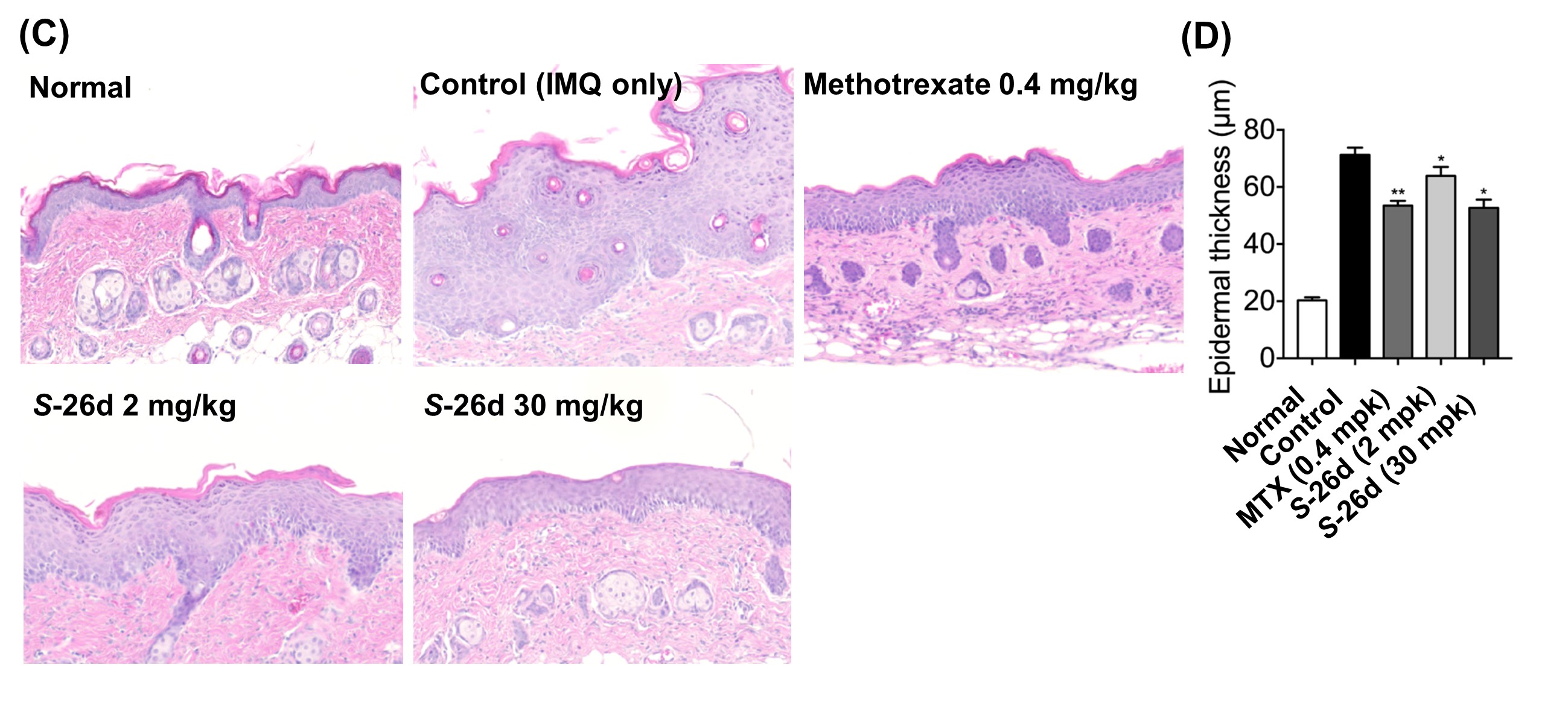 Professor Yong-Chul Kim's research team finds clues to developing an effective 'edible medicine' for treating skin disease 'psoriasis' 이미지