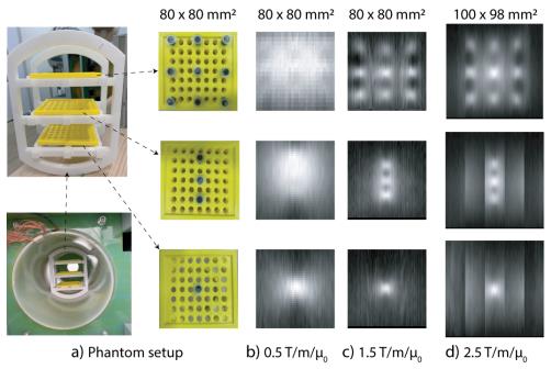 Developing a human-scale magnetic particle imaging (MPI) device using superconducting coils could lead to personalized brain disease treatment 이미지