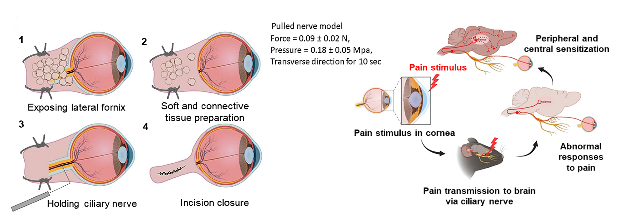 "They say that if you get vision correction surgery, your eyes feel like they're being cut by glass" Professor Euiheon Chung's research team suggests a new treatment possibility for neuropathic corneal pain 이미지