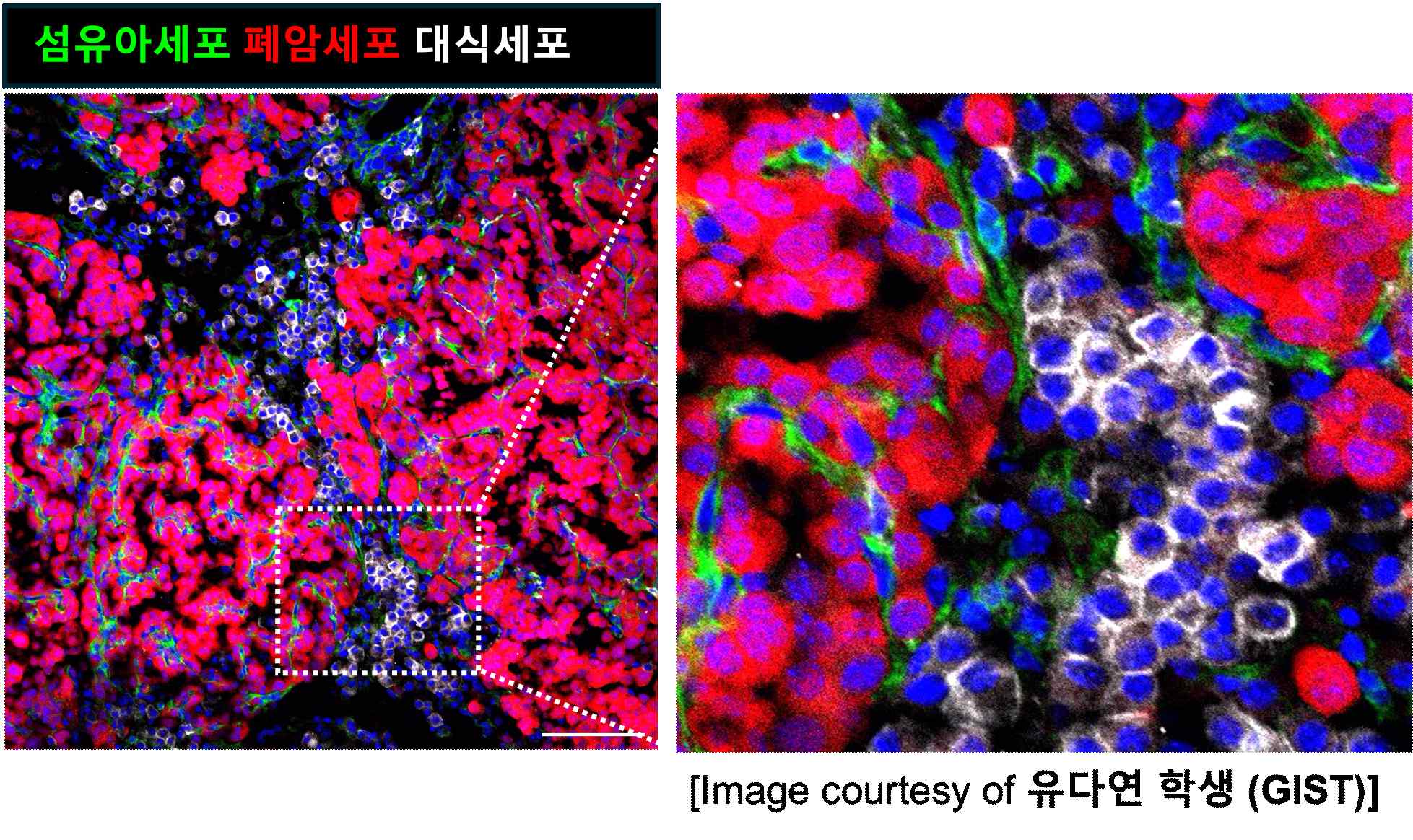 “Before cancer grew, the ‘soil’ inside the body was changing” GIST, for the first time in the world, identifies the process of formation of a ‘tumor-friendly microenvironment’ prior to lung cancer development… published in *Nature* 이미지